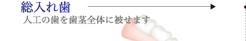 総入れ歯：人工の歯を歯茎全体に被せます